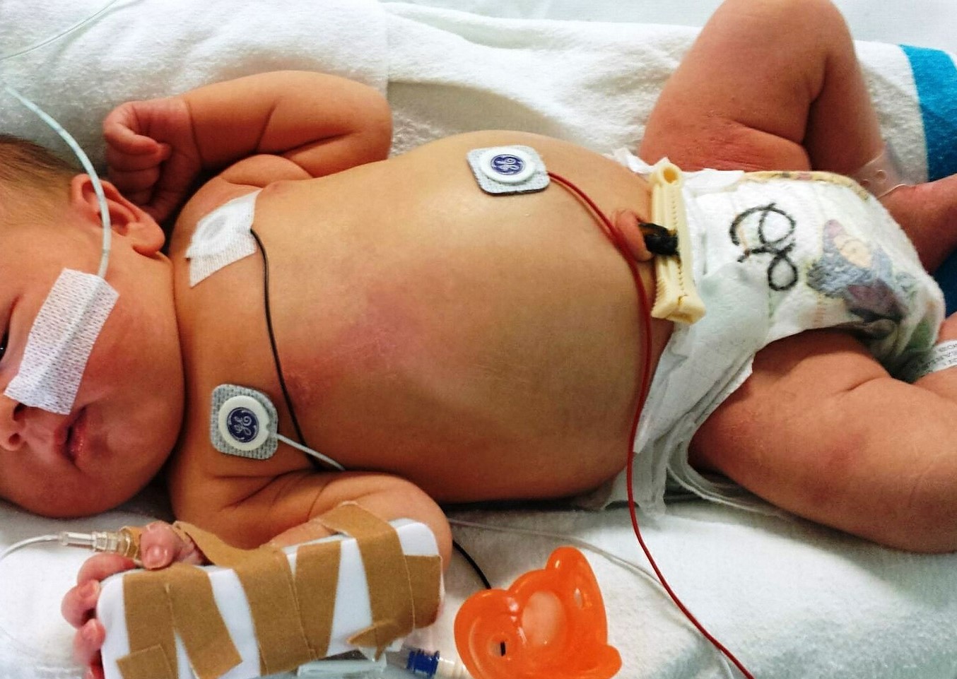 Chronically Ill Baby | Kids Car Donations